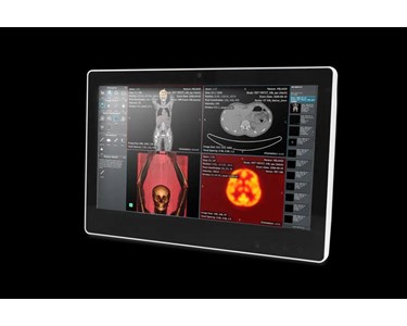 Onyx - 15.6" Fanless Slim Medical All In One PC | SMA-1533