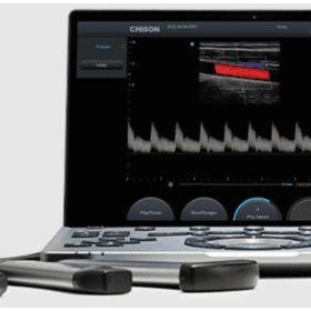 SonoAir 70 VET Ultrasound