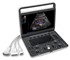 SonoScape E2 Colour Doppler Portable Ultrasound Scanner