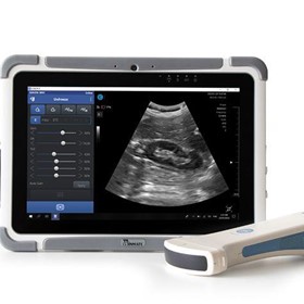 Wireless Portable Ultrasound