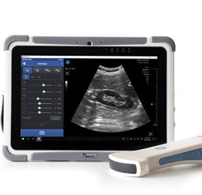 Wireless Portable Ultrasound