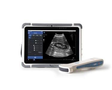 Visionflex - Wireless Portable Ultrasound