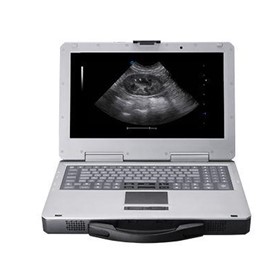 V3 Veterinary Color Doppler Ultrasound Imaging System