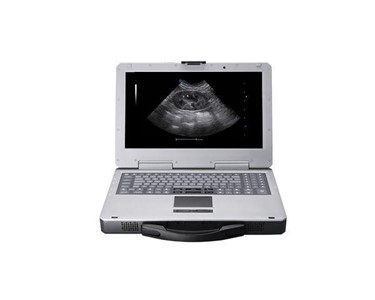 Siui - V3 Veterinary Color Doppler Ultrasound Imaging System