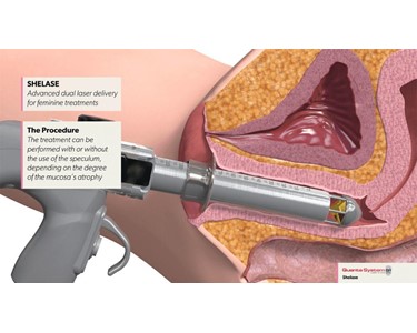 Quanta System - Cosmetic Lasers | Vaginal Tightening Device | SheLase