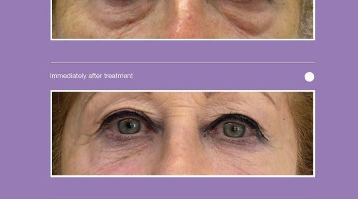 Results of Treatment