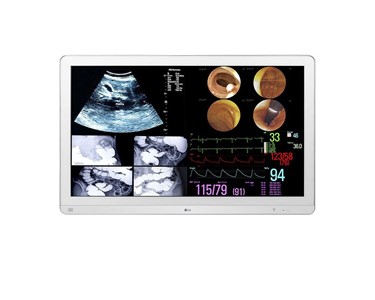 LG - Surgical Monitor | 31.5” 4K IPS | 32HL710S-W​ | Medical monitor