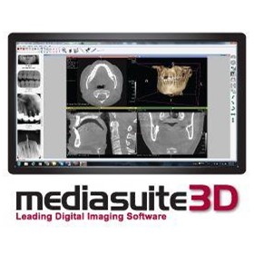 Mediasuite 3D Dental Digital Imaging Software