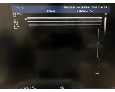 Philips - L12-5 | Linear Transducer | EX2555