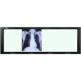 X-Ray Viewing Box | 4 Bay ATX LED