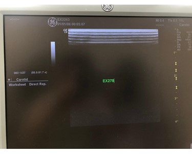 GE - 11L [Ultrasound Transducer] [ EX278]