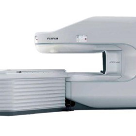 Permanent Magenet Open MRI System 0.4T | APERTO Lucent Plus