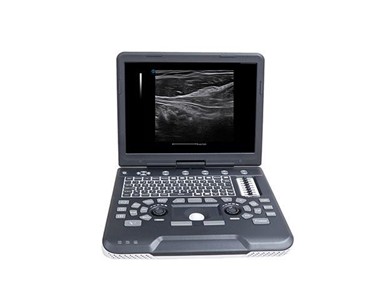 Siui - Portable Ultrasound Machine | Apogee 1000