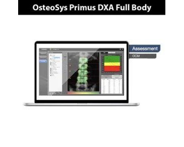 Bone Densitometer | OsteoSys Primus DXA Full Body