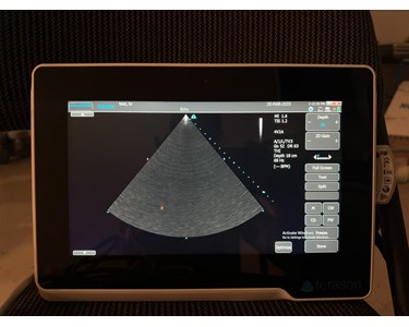 Terason - u3200T Ultrasound