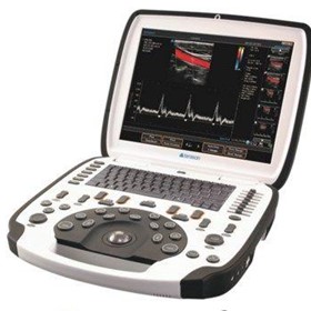 uSmart 3300 NexGen Colour Doppler Ultrasound Machine
