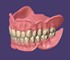 ExoCad - Dental Imaging Software | Stand Alone Full Denture Module