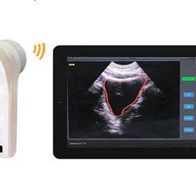 Wireless 4D Bladder Scanner