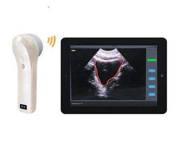 Wireless 4D Bladder Scanner