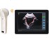 Wireless 4D Bladder Scanner