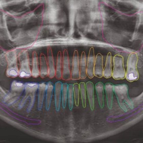 Dental Imaging Software – NeoWise