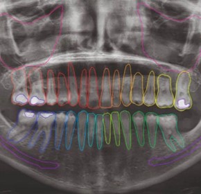 Dental Imaging Software – NeoWise