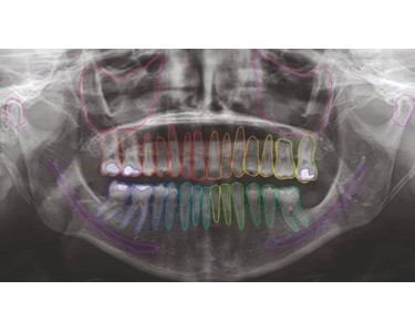 NeoWise Software - Dental Imaging Software – NeoWise
