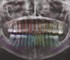 NeoWise Software - Dental Imaging Software – NeoWise