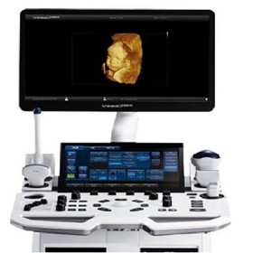 Ultrasound Machines | VINNO M86