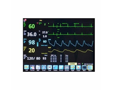 Northern Meditec - Taurus ICU Multiparameter Patient Monitor 