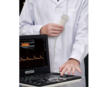 Vinno - Portable Ultrasound | VINNO A3
