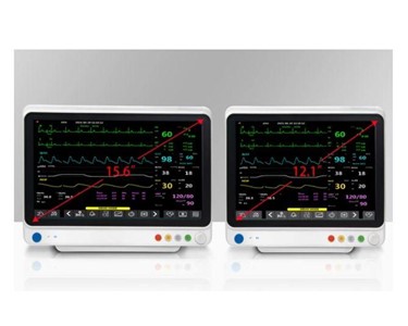 APS Technology Australia - Intensive Care Patient Monitoring System