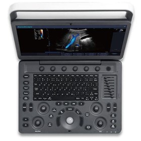 Portable Ultrasound Machine |  E2 Pro