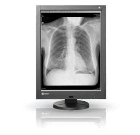 Diagnostic Monitor | RadiForce GX340