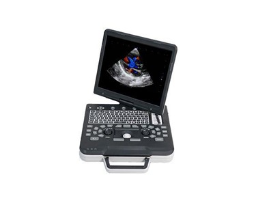 Siui - Portable Ultrasound Machine | Apogee 1000 Pro