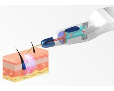 Plaxpot - Plasma Fibroblast Pen 