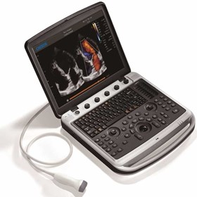 Ultrasound Equipment | Sonobook 9