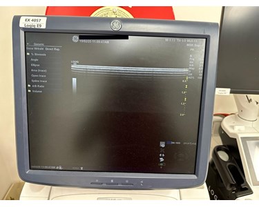 GE - Logiq E9 | Ultrasound Machine | EX4057
