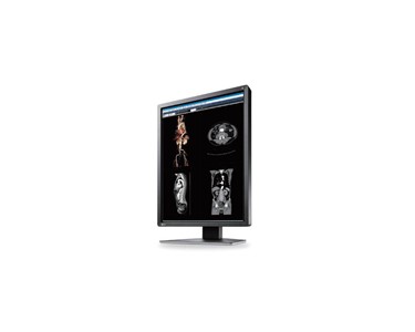 Eizo RadiForce MX216 21″ 2MP Clinical Review Medical Grade Monitor