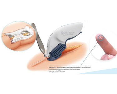 Absorbable Skin Stapler | INSORB 