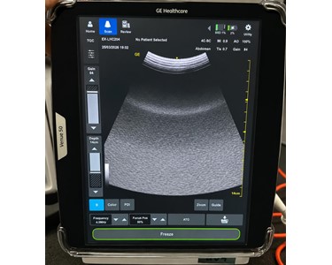 GE - Venue 50 Ultrasound EX-LHC204