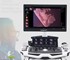 Vinno - Ultrasound System | Ultimus 9e | Cart-based  