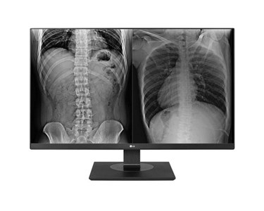 LG - 27" 8MP Clinical Review Monitor