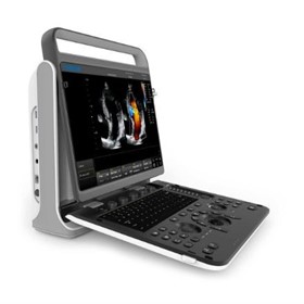 Portable Ultrasound Equipment EBit60