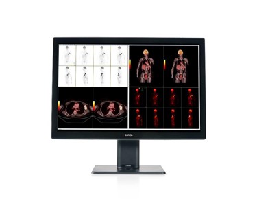 Barco - Diagnostic Displays
