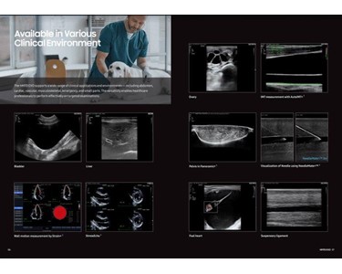 Samsung HM70 EVO Ultrasound