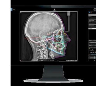 OPG X-Ray Machine | Carestream CS 8100 Evo Edition