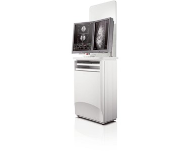 Digital Mammography | Amulet Sophinity