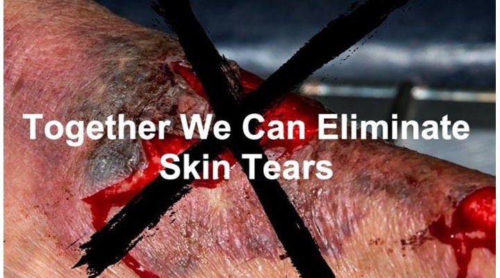 Eliminate Skin Tears