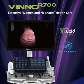 Ultrasound System | R700